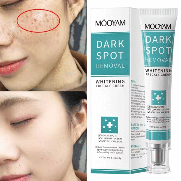 Dark Spot Remover Cream - Image 2